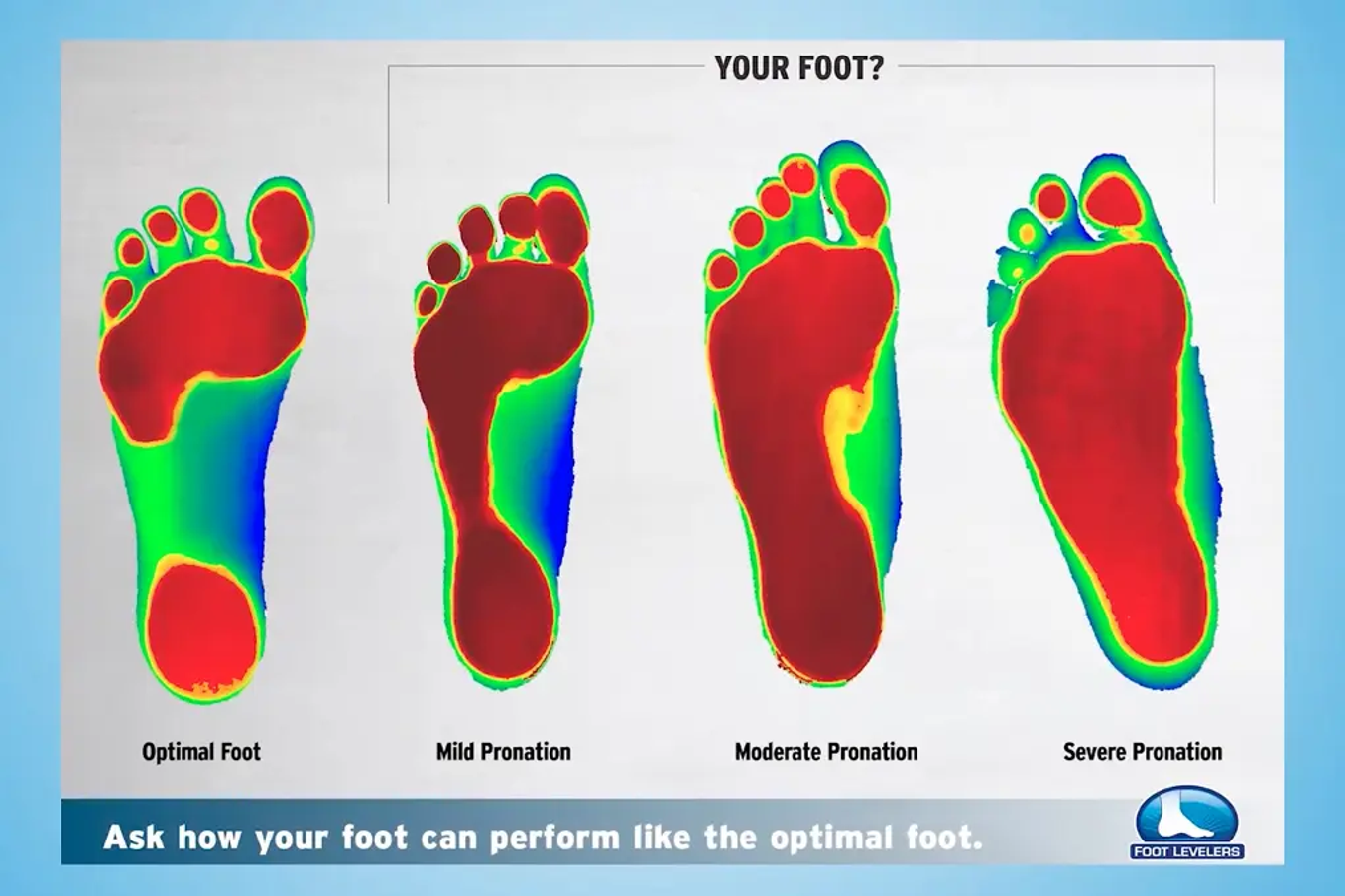foot problems requiring custom orthotics